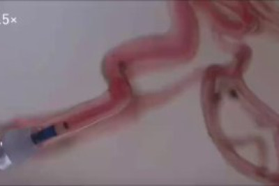 Ученые разработали робота-«песчинку», который умеет «плавать» по сосудам