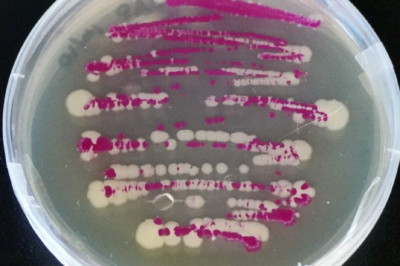 Учёные нашли бактерию, которая умеет притворяться мертвой